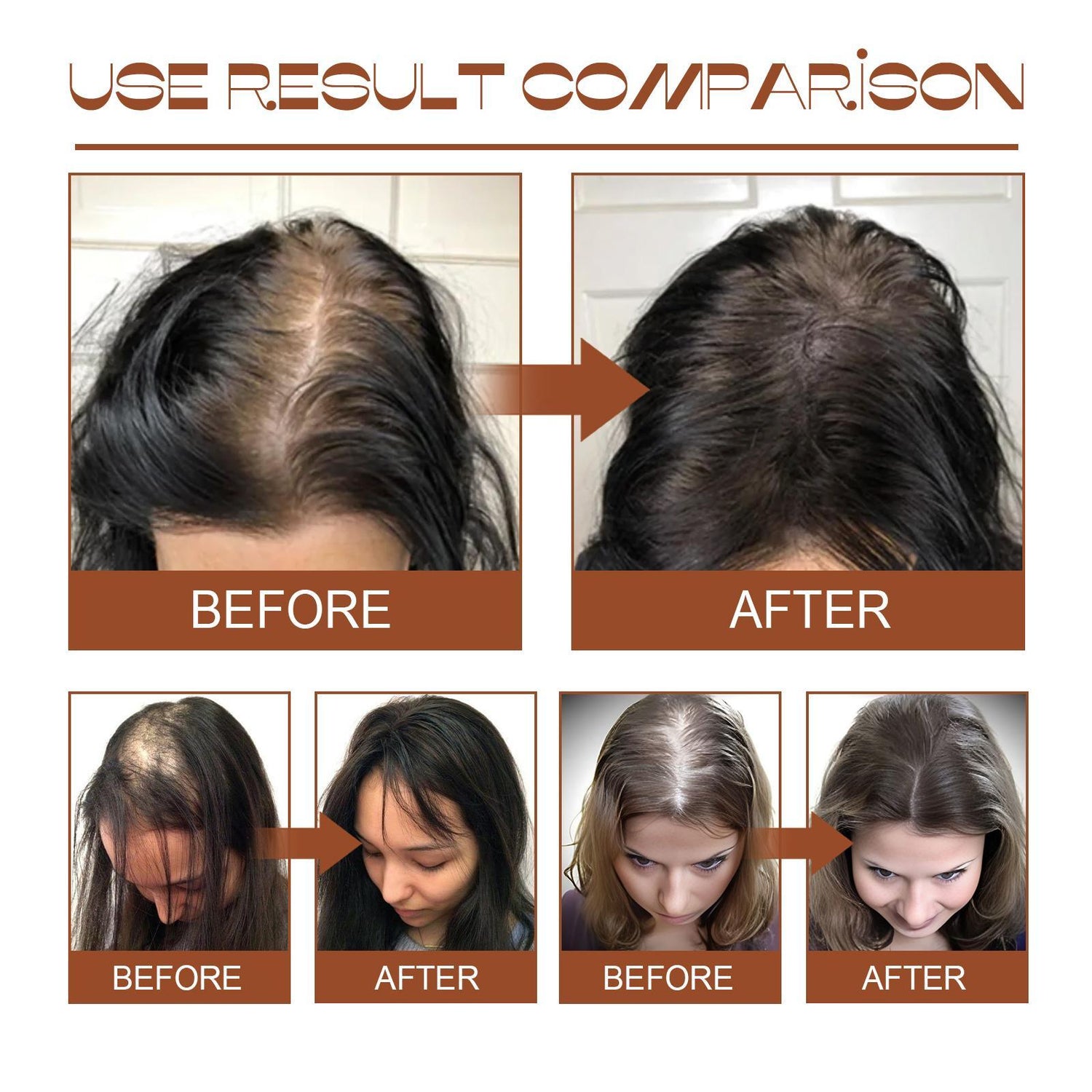 hair growth oil
